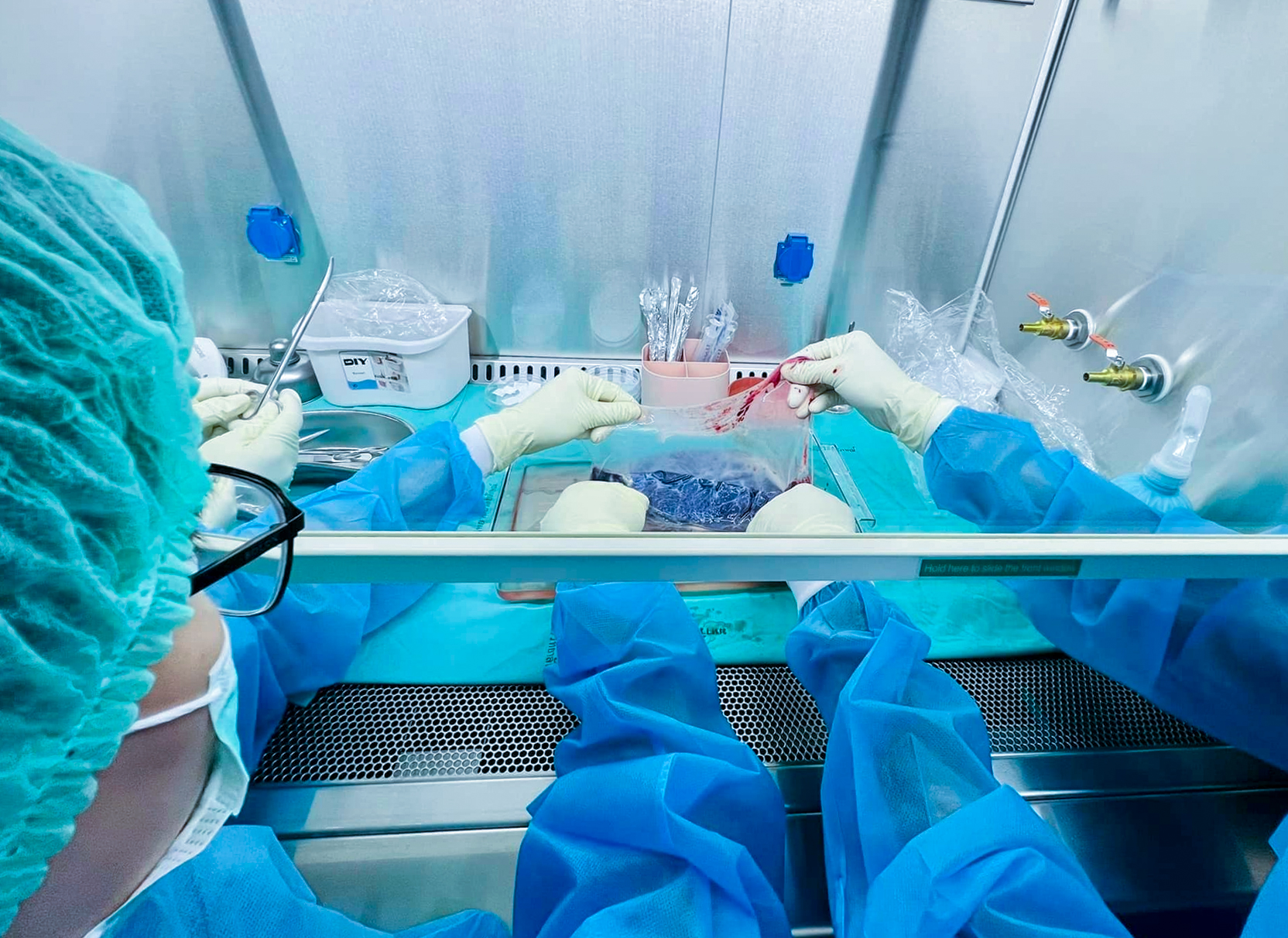 Walailak University Hospital in Coordination with Research Institute for Health Sciences Succeeds in Producing Placental Membranes for Medical Use as the Second in the South of Thailand